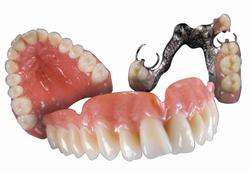 протезирование зубов съёмное, бюгельное, несъёмное